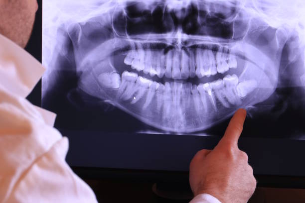 Best Urgent Care for Lost Fillings or Crowns in St Anthony, MN