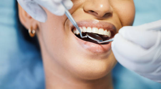Best Emergency Dental Care for Broken or Chipped Teeth in St Anthony, MN