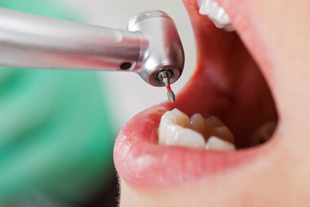 Best Emergency Gum Treatment in St Anthony, MN